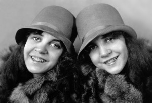 The real Hilton twins, at about age 16, circa 1927. (Photo courtesy Wellcome Library, London) 